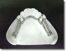 	
コバルトクロム床義歯