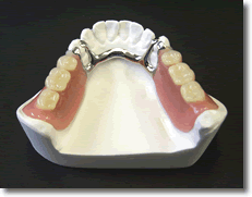 	
コバルトクロム床義歯